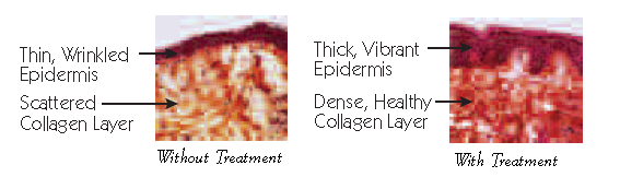 ART ART-epidermis-colagen